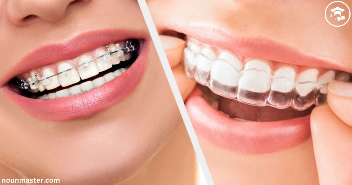 Comfort and Maintenance: Veneers or Invisalign?